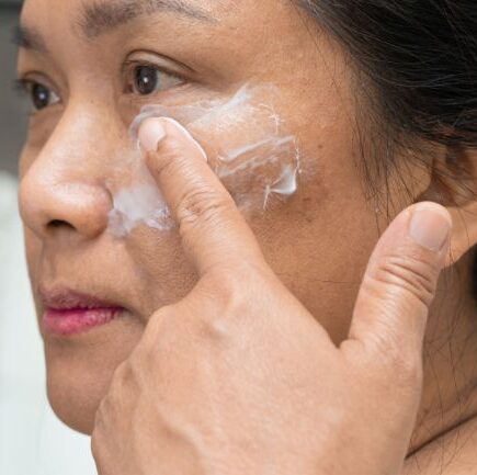 Melasma e protetor solar como escolher e usar corretamente